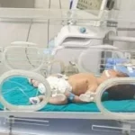 مستشفى كوم أمبو يحقق التطور في الخدمات الطبية بأسوان