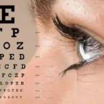 وداعًا للنظارات مع عملية الليزك