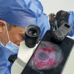 خطوات العلاج على نفقة الدولة