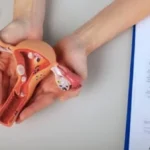 أعراض الرحم ذو القرنين وتأثيره على الحمل