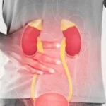 عوامل غير شائعة تسبب أمراض الكلى