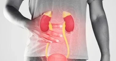 عوامل غير شائعة تسبب أمراض الكلى