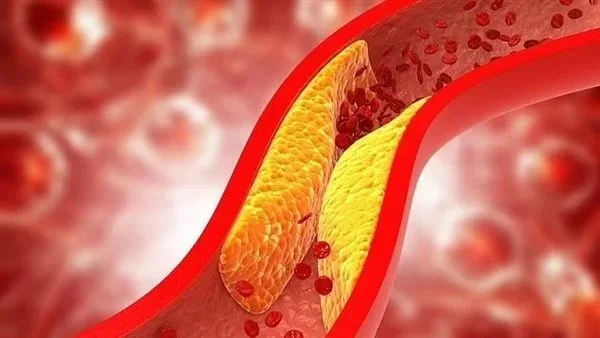 تناول التفاح يومياً لدعم صحة القلب وتقليل الكوليسترول