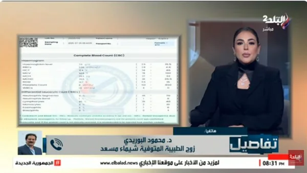 مأساة “اللوبس”.. تفاصيل صادمة عن رحلة علاج دكتورة شيماء