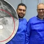 استخراج جسم معدني من معدة طفلة في مستشفى دسوق العام