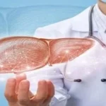 عادات غذائية تضر بالكبد وكيفية الحماية منها