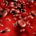 علامات تشير إلى إصابتك بفقر الدم الحاد