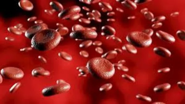 علامات تشير إلى إصابتك بفقر الدم الحاد