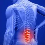 أسباب وأعراض ألم العصعص وطرق العلاج