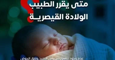 كيفية اتخاذ قرار الولادة القيصرية