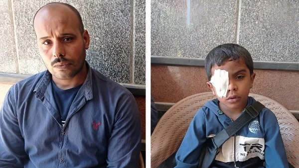 استغاثة أب لإنقاذ بصر ابنه بعد اعتداء زملائه
