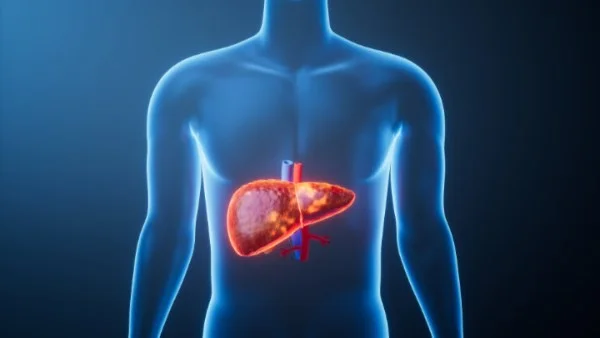 مرض الكبد الدهني: 1.8 مليار مهددون بحلول 2050
