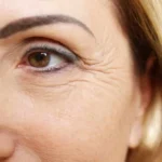 ماسكات طبيعية للتخلص من التجاعيد وشد البشرة