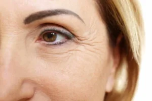 ماسكات طبيعية للتخلص من التجاعيد وشد البشرة