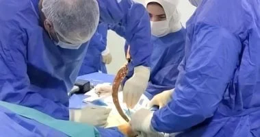 إنقاذ قدم طفل بمستشفى دسوق العام بعد إصابة خطيرة