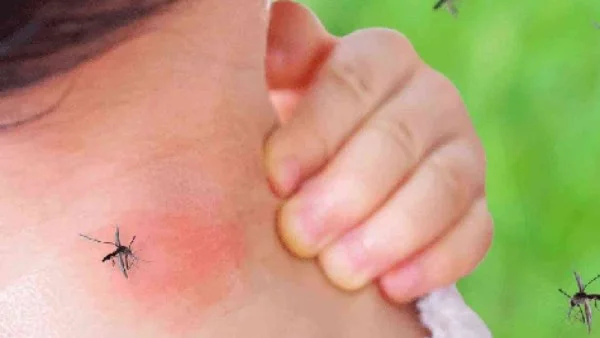 لماذا ينجذب البعوض لبعض البشر أكثر من غيرهم؟