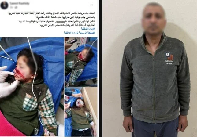 خلاف زراعي في دمياط يؤدي لإصابة طفلة وضبط الجاني