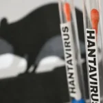 تحذيرات طبية من فيروس هانتا وأعراضه وطرق انتقاله