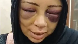 تفاصيل اعتداء خطيب سابق على فتاة في بورسعيد