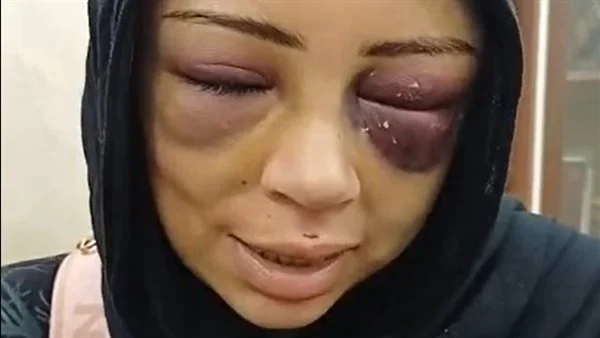 تفاصيل اعتداء خطيب سابق على فتاة في بورسعيد