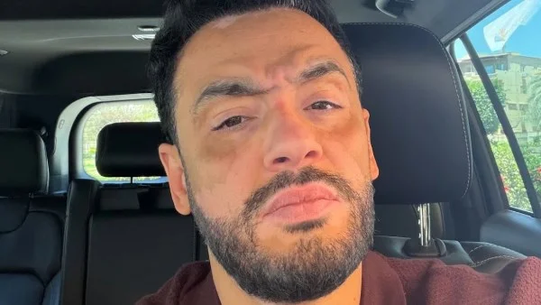 رامي جمال يثير التفاعل بملامح حزينة وألبوم جديد