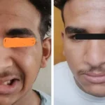 إنجاز طبي في جامعة أسيوط يعيد وظائف العصب الوجهي
