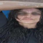 أمير كرارة يدعم شقيقته نسرين بعد حديثها عن البهاق