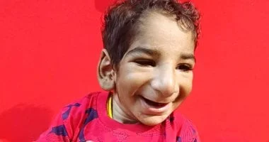 رحلة أنس: من صدمة الولادة إلى التوعية ضد التنمر