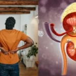 علامات تحذيرية تميز ألم الظهر عن حصوات الكلى