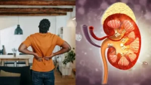 علامات تحذيرية تميز ألم الظهر عن حصوات الكلى