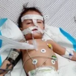 نبيل حميدة: رحلة صعبة مع الشلل الدماغي في غزة