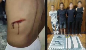 اعتداء على جزار في الإسكندرية وأسلحة بيضاء تتسبب في الفوضى