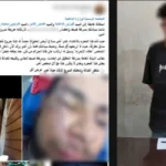 اعتداء بشع على شاب في كفر الشيخ باستخدام سلاح أبيض
