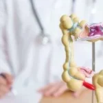 آلية جديدة توضح سبب عودة سرطان القولون بعد الشفاء