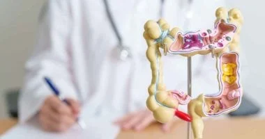 آلية جديدة توضح سبب عودة سرطان القولون بعد الشفاء