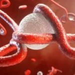 تعافي أول مصاب بإيبولا في فرنسا