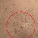 نجاح جراحة دقيقة في المنصورة لإنقاذ حياة طفل