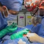 نجاح جراحة لتصحيح تشوه خلقي لرضيع بالقنايات