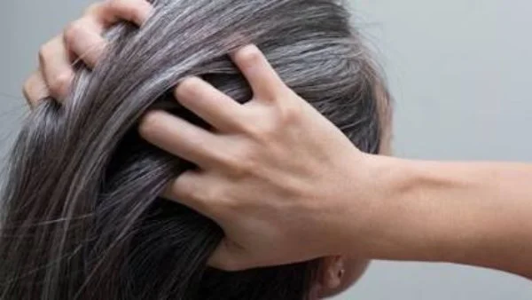 أسباب الشيب المبكر وتأثيراته