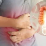 الإسهال المتكرر في الصيف: علامة على التهاب القولون التقرحي