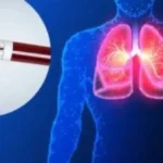 نجاح مصر في خفض معدلات تليف وسرطان الكبد