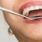 علامات بالفم تشير لأمراض خطيرة غير مرتبطة بالأسنان
